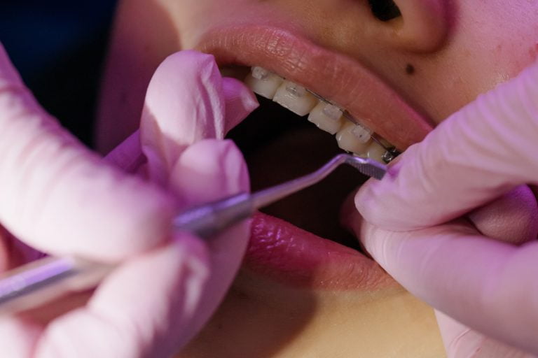 dental-restoration