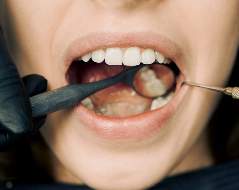 tooth-filling