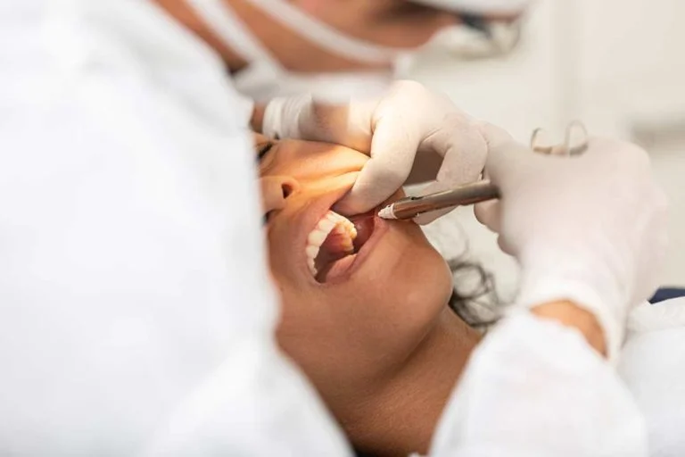 wisdom-teeth-dento-blog